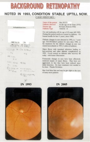 Diabetic Retinopathy